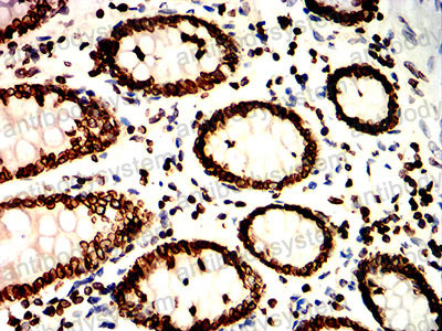 Валидация AntibodySystem RHD40902 (1571)