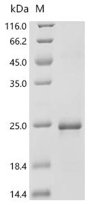SDS-PAGE