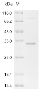 SDS-PAGE