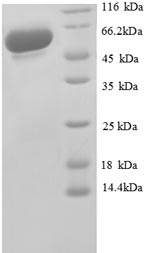 SDS-PAGE