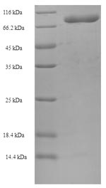 SDS-PAGE