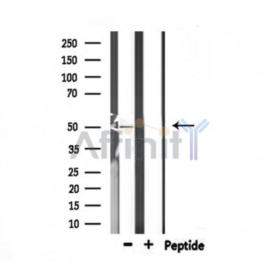 Валидация Affinity DF6889 - 18478