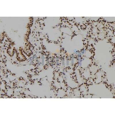 Валидация Affinity AF6170 - 3390