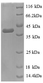 SDS-PAGE
