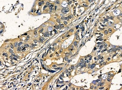 Валидация Affinity DF14181 - 9992