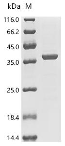 SDS-PAGE