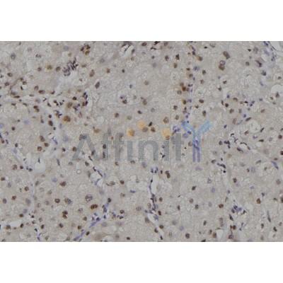 Валидация Affinity AF6183 - 3405