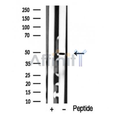 Валидация Affinity DF10335 - 5957