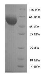 SDS-PAGE