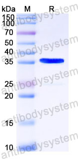 YHC67401, SDS-PAGE