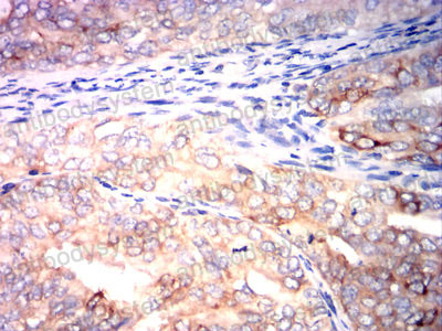 Валидация AntibodySystem RHA32302 (105)