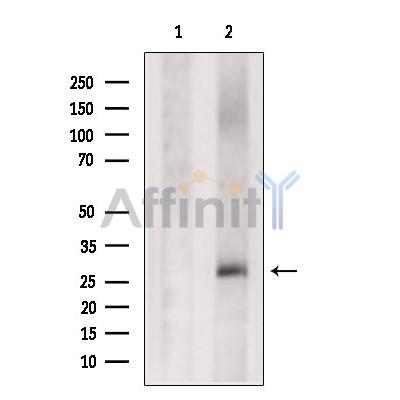 Валидация Affinity DF6762 - 18325