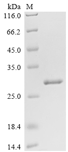 SDS-PAGE
