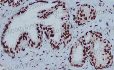 Валидация AntibodySystem RHG43409