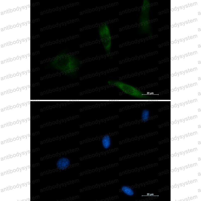 Валидация IF - AntibodySystem RHB86913