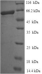 SDS-PAGE