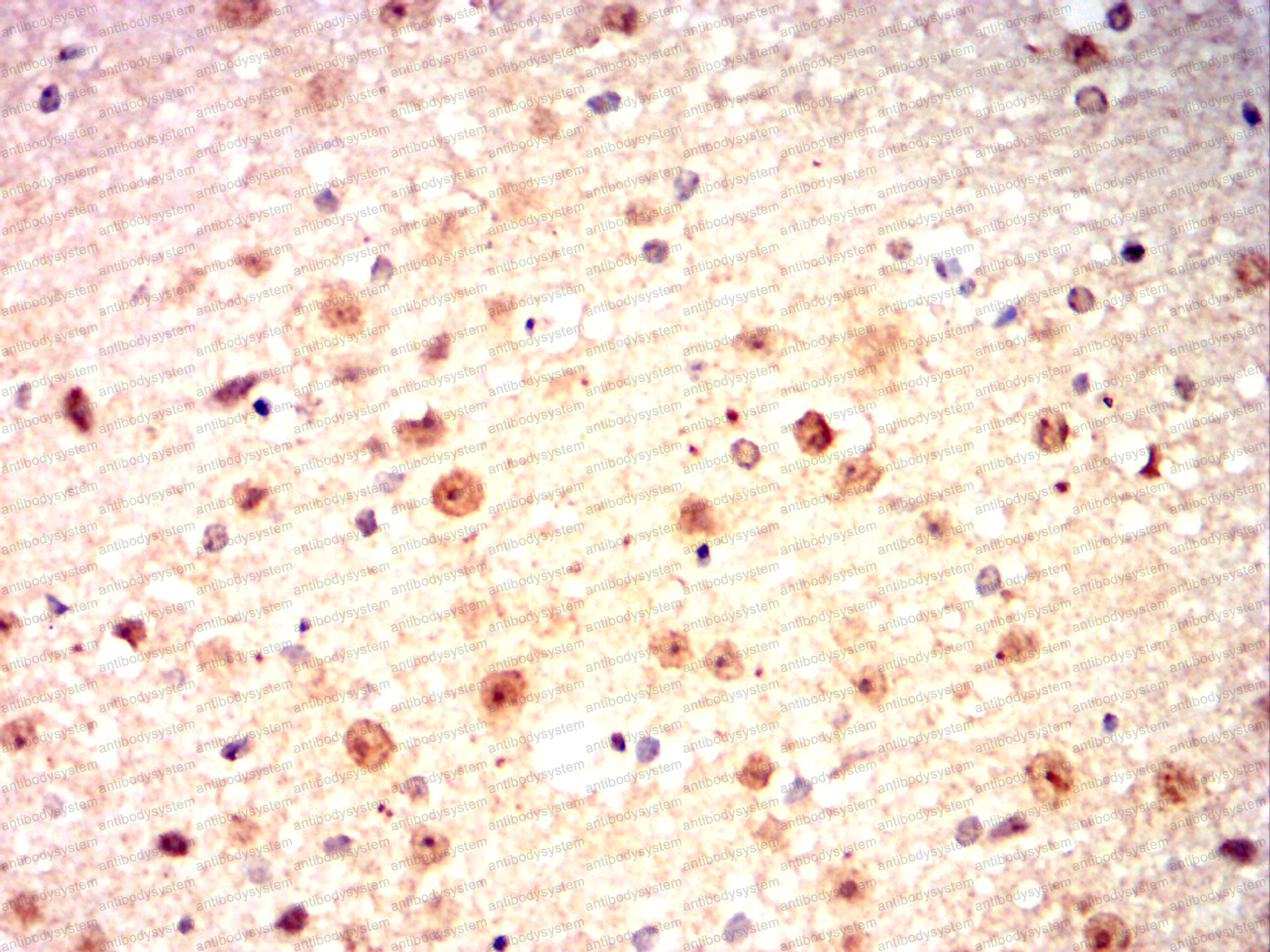 Валидация AntibodySystem RHG90002 (3110)