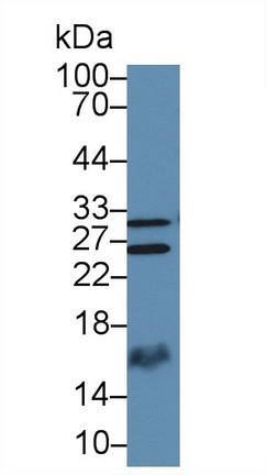 13862