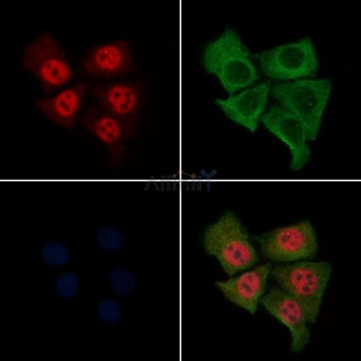 Валидация Affinity DF6103 - 17320