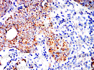 Валидация AntibodySystem RHD66203 (1697)