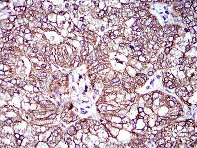 Валидация AntibodySystem RHA52901
