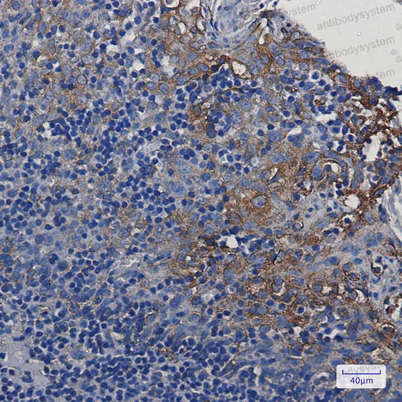 Валидация AntibodySystem RHJ16701