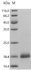 SDS-PAGE