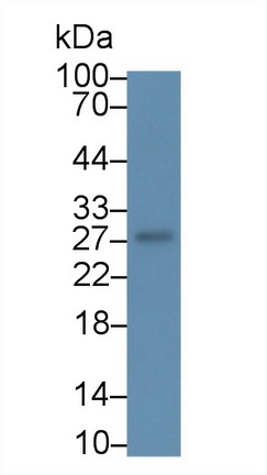 19295