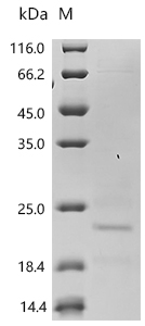 SDS-PAGE