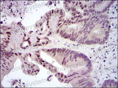 Валидация AntibodySystem RHB90703 (442)