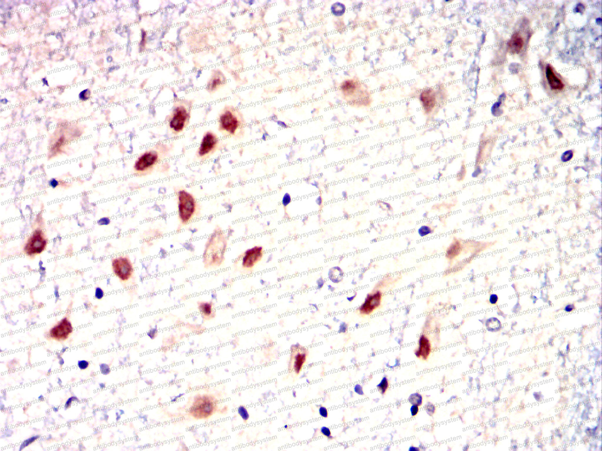 Валидация AntibodySystem RHJ52502 (3454)