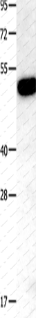 Вестерн-блоттинг, TNFRSF11B, ткань почки мыши