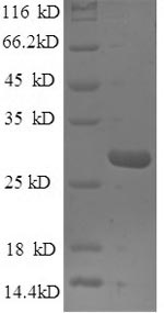 SDS-PAGE