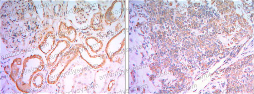Валидация AntibodySystem RHD33302