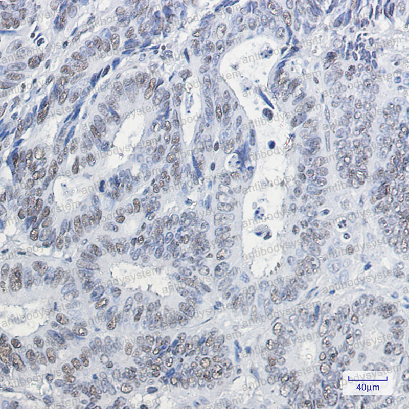 Валидация AntibodySystem RMG43401