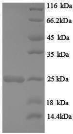 SDS-PAGE