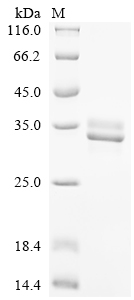 SDS-PAGE