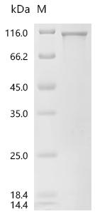 SDS-PAGE