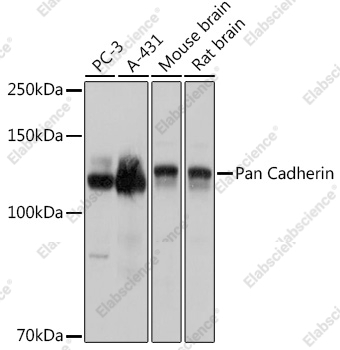 Вестерн-блоттинг, Pan Cadherin, различные клеточные линии
