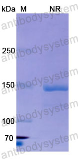 Валидация SDS-PAGE - AntibodySystem DHJ45501