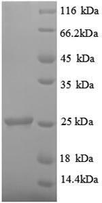 SDS-PAGE