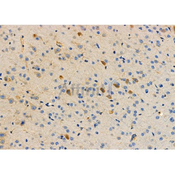 Валидация Affinity DF6159 - 17400