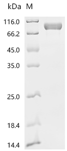 SDS-PAGE