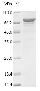 SDS-PAGE