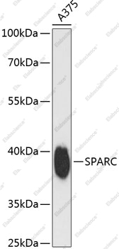 Вестерн-блоттинг, SPARC, клетки A375