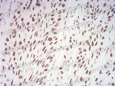 Валидация AntibodySystem RHK75501 (3728)