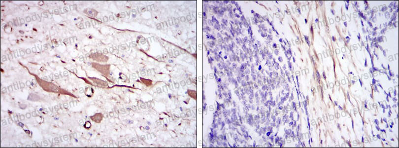 Валидация AntibodySystem RHC10502 (629)