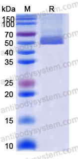 EHK05701, SDS-PAGE