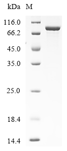 SDS-PAGE