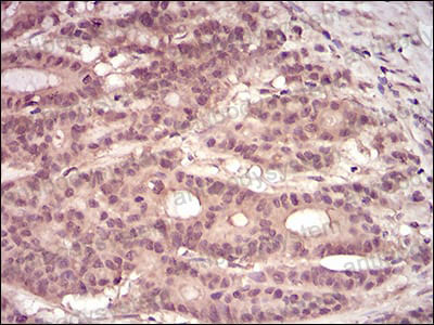 Валидация AntibodySystem RHH26902